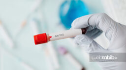 تست و آزمایش خون anti tpo و لوله آزمایش خون