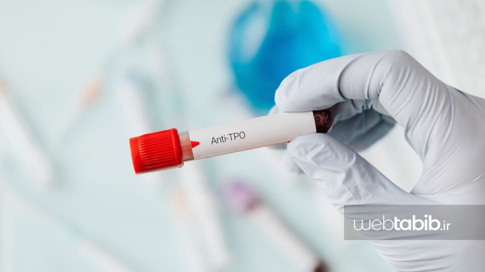 تست و آزمایش خون anti tpo و لوله آزمایش خون