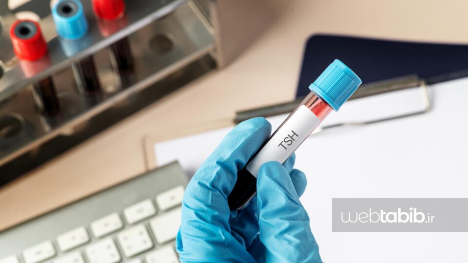 نمونه خون در لوله آزمایش برای آزمایش TSH