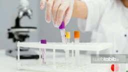 آزمایش T3 خون و لوله‌های آزمایش