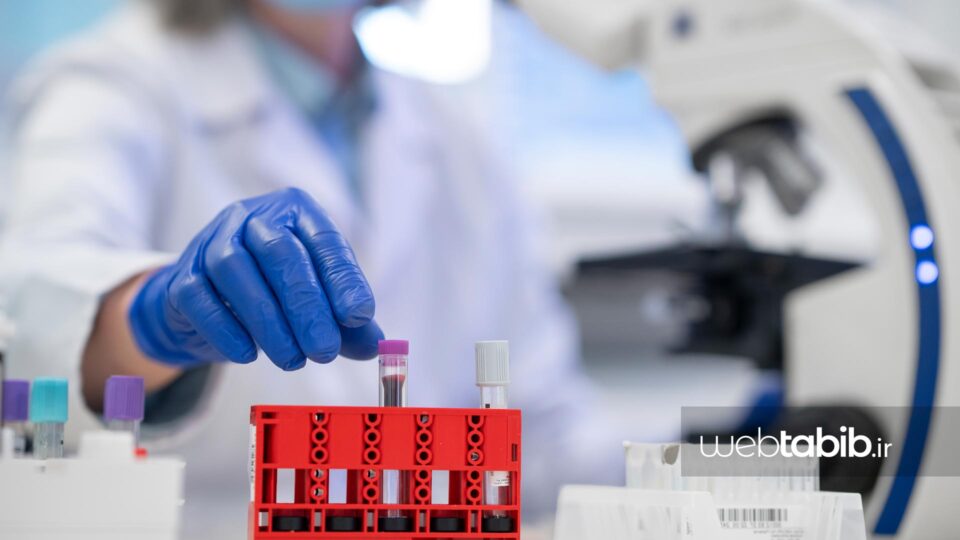 لوله آزمایش خون T4 بیماران