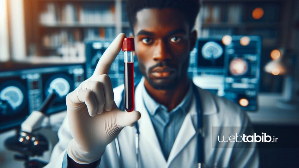 آزمایش تیروگلوبولین (tg) در خون با لوله آزمایش